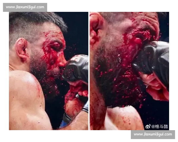 肘击定音!琼斯 UFC 巴黎赛 TKO 奥基延续连胜 肘击定音!琼斯 UFC 巴黎赛 TKO 奥基延续连胜
